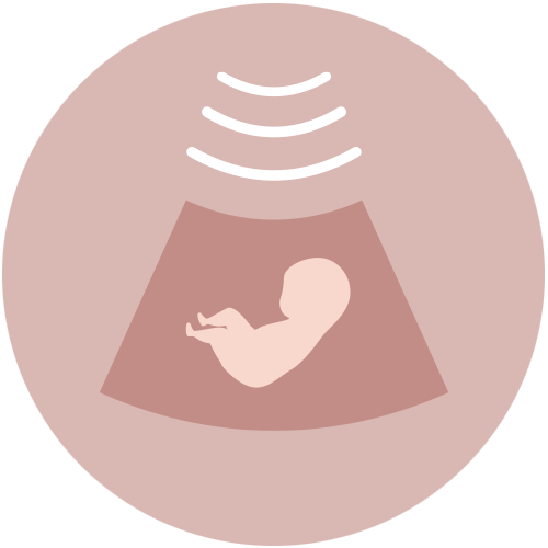 Echoscopie