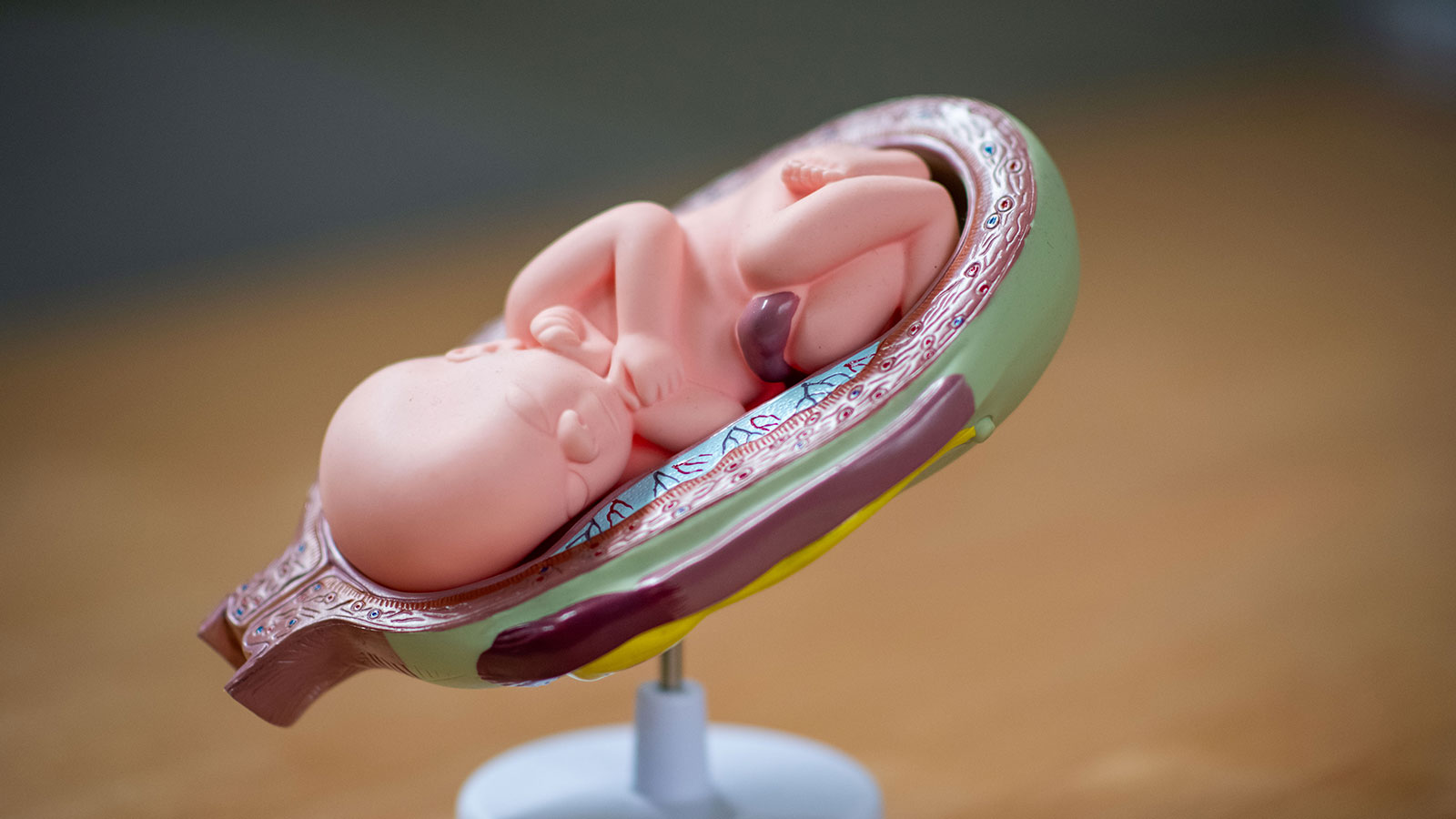 Tijdens je zwangerschap is het belangrijk om gezond en gevarieerd te eten volgens de Schijf van Vijf.